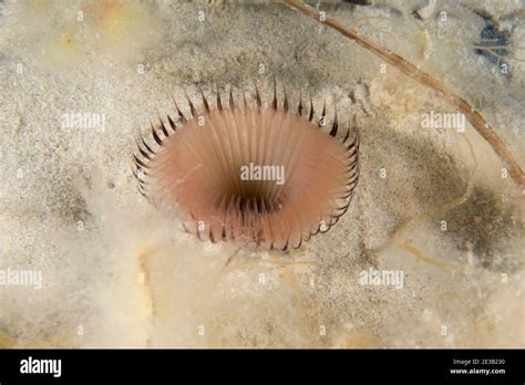  Eylash Worm: A Glimpse into the Microcosm of Freshwater Environments!