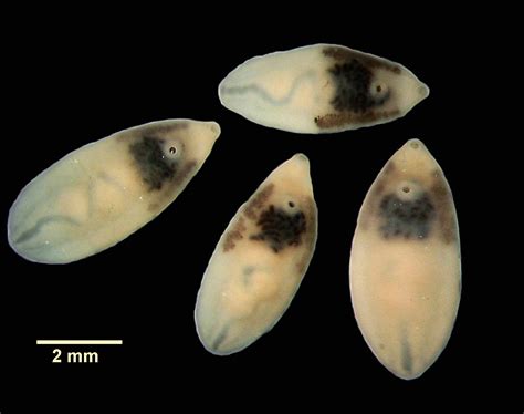  Metorchis conjunctus: 探索寄生在魚類的肝臟中的奇妙蟲！